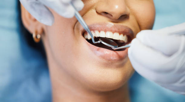 Best Teeth Whitening  in Davis, CA