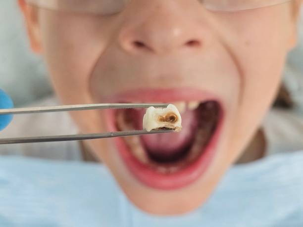 Best Tooth Pain Emergency Relief  in Davis, CA