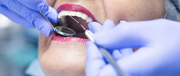 Best Broken Tooth Emergency  in Davis, CA